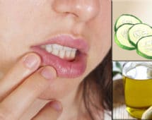 imagen Repara tus labios agrietados con estos remedios caseros