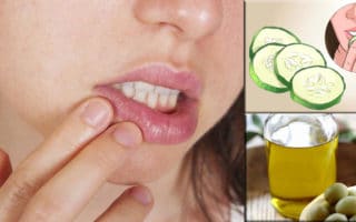 imagen Repara tus labios agrietados con estos remedios caseros