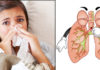 imagen Los mejores remedios naturales para tratar la bronquitis
